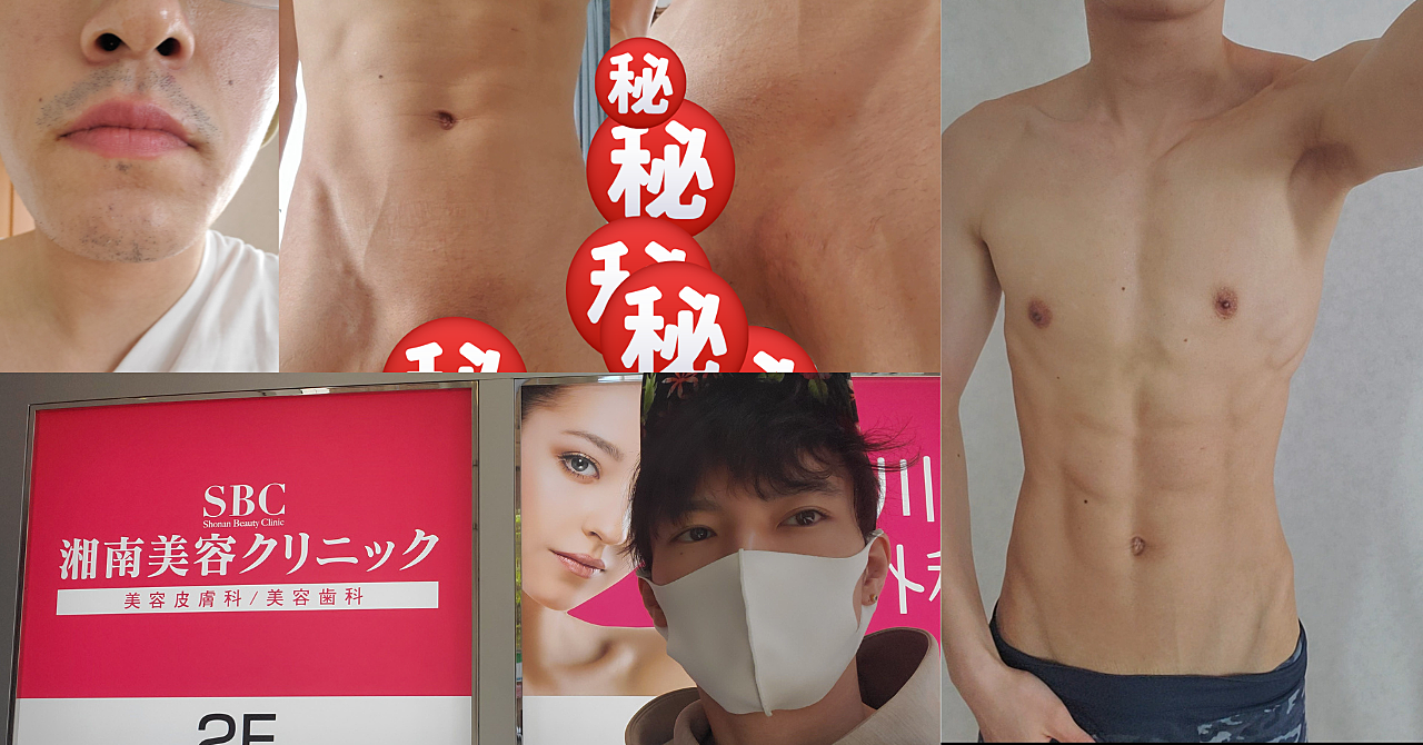 【※閲覧注意】写真901枚で脱毛経過を振り返る【ヒゲ、VIO、全身】